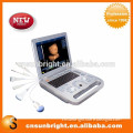 Promotion ! Cheapest 4D Cardiac color ultrasonic transducer for hospital